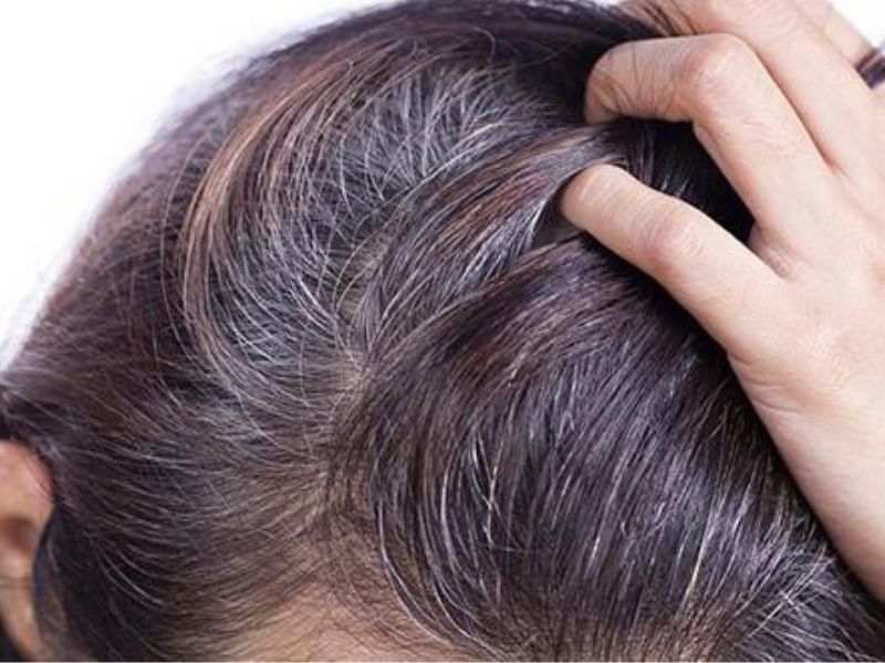 Có nên nhuộm tóc phủ bạc không?